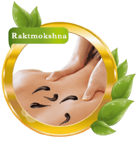 Raktamokshana – Blood Purification